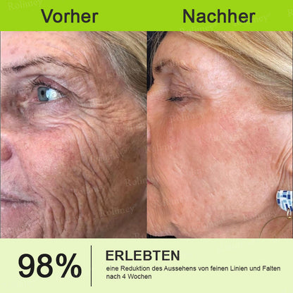 🛡️Jetzt jugendliche Haut zurückgewinnen Rolimey® Botox & Vita-A Retinol Shot Falten-Lift Straffungscreme