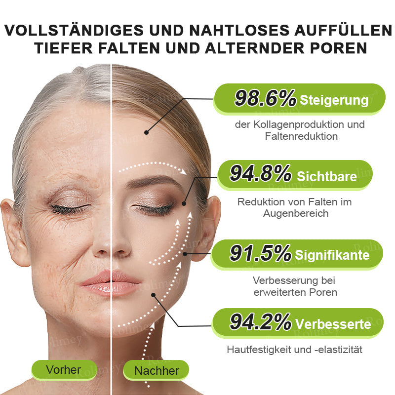 🛡️Jetzt jugendliche Haut zurückgewinnen Rolimey® Botox & Vita-A Retinol Shot Falten-Lift Straffungscreme