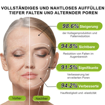 🛡️Jetzt jugendliche Haut zurückgewinnen Rolimey® Botox & Vita-A Retinol Shot Falten-Lift Straffungscreme