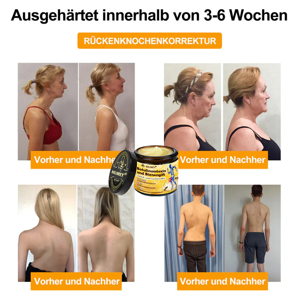 🥰 Offizieller Shop: Rolimey® Bienengift-Schmerzlinderungs Knochenheilungs Creme 👨‍⚕️(Reduzierung von Gelenkschwellungen, Schmerzen, Steifheit, Rötungen, Wärme, Muskelkater und Gelenkmüdigkeit)