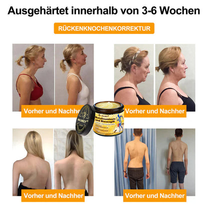 🥰 Offizieller Shop: Rolimey® Bienengift-Schmerzlinderungs Knochenheilungs Creme 👨‍⚕️(Reduzierung von Gelenkschwellungen, Schmerzen, Steifheit, Rötungen, Wärme, Muskelkater und Gelenkmüdigkeit)