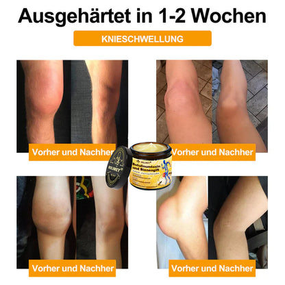 🥰 Offizieller Shop: Rolimey® Bienengift-Schmerzlinderungs Knochenheilungs Creme 👨‍⚕️(Reduzierung von Gelenkschwellungen, Schmerzen, Steifheit, Rötungen, Wärme, Muskelkater und Gelenkmüdigkeit)