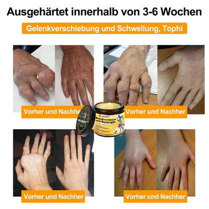 🥰 Offizieller Shop: Rolimey® Bienengift-Schmerzlinderungs Knochenheilungs Creme 👨‍⚕️(Reduzierung von Gelenkschwellungen, Schmerzen, Steifheit, Rötungen, Wärme, Muskelkater und Gelenkmüdigkeit)