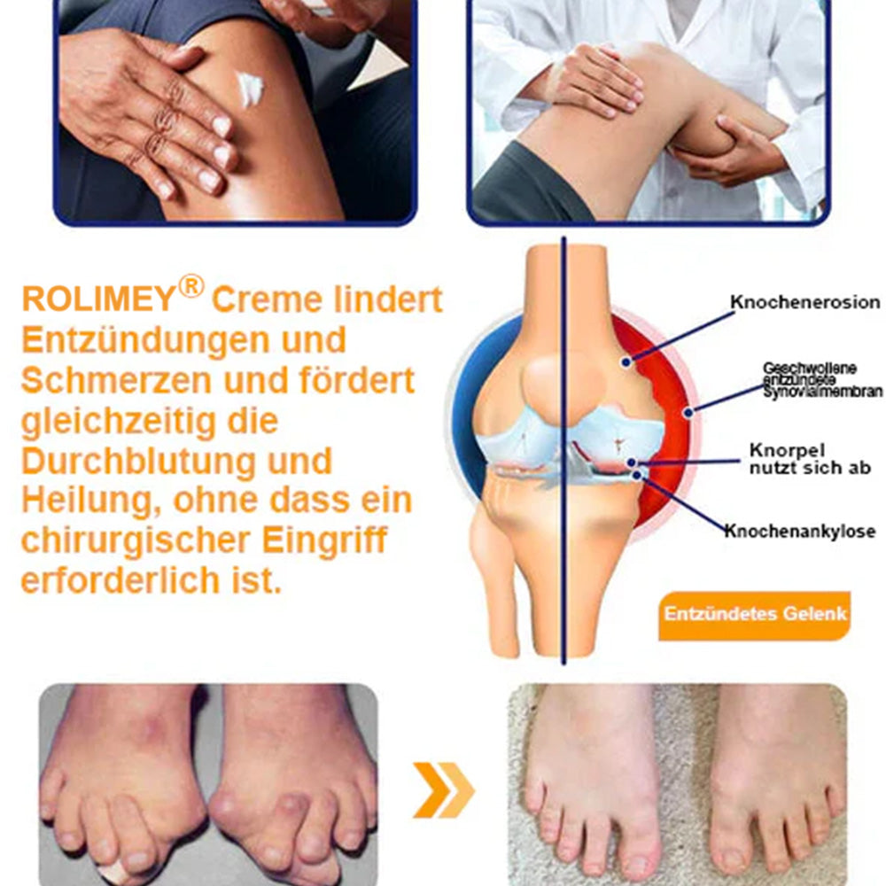 🥰 Offizieller Shop: Rolimey® Bienengift-Schmerzlinderungs Knochenheilungs Creme 👨‍⚕️(Reduzierung von Gelenkschwellungen, Schmerzen, Steifheit, Rötungen, Wärme, Muskelkater und Gelenkmüdigkeit)