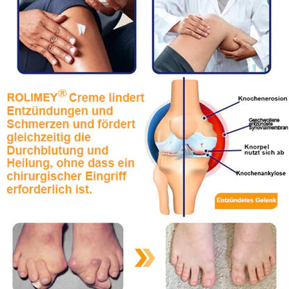 🥰 Offizieller Shop: Rolimey® Bienengift-Schmerzlinderungs Knochenheilungs Creme 👨‍⚕️(Reduzierung von Gelenkschwellungen, Schmerzen, Steifheit, Rötungen, Wärme, Muskelkater und Gelenkmüdigkeit)