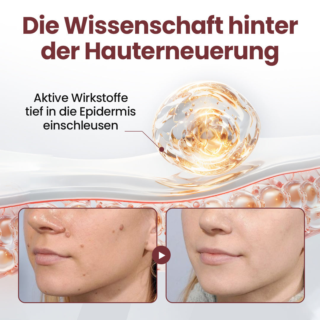 𝙀𝙫𝙤𝙡𝙫𝙞𝙤𝙣® KeraErase Dual-Action Erneuerungscreme