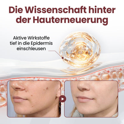 𝙀𝙫𝙤𝙡𝙫𝙞𝙤𝙣® KeraErase Dual-Action Erneuerungscreme