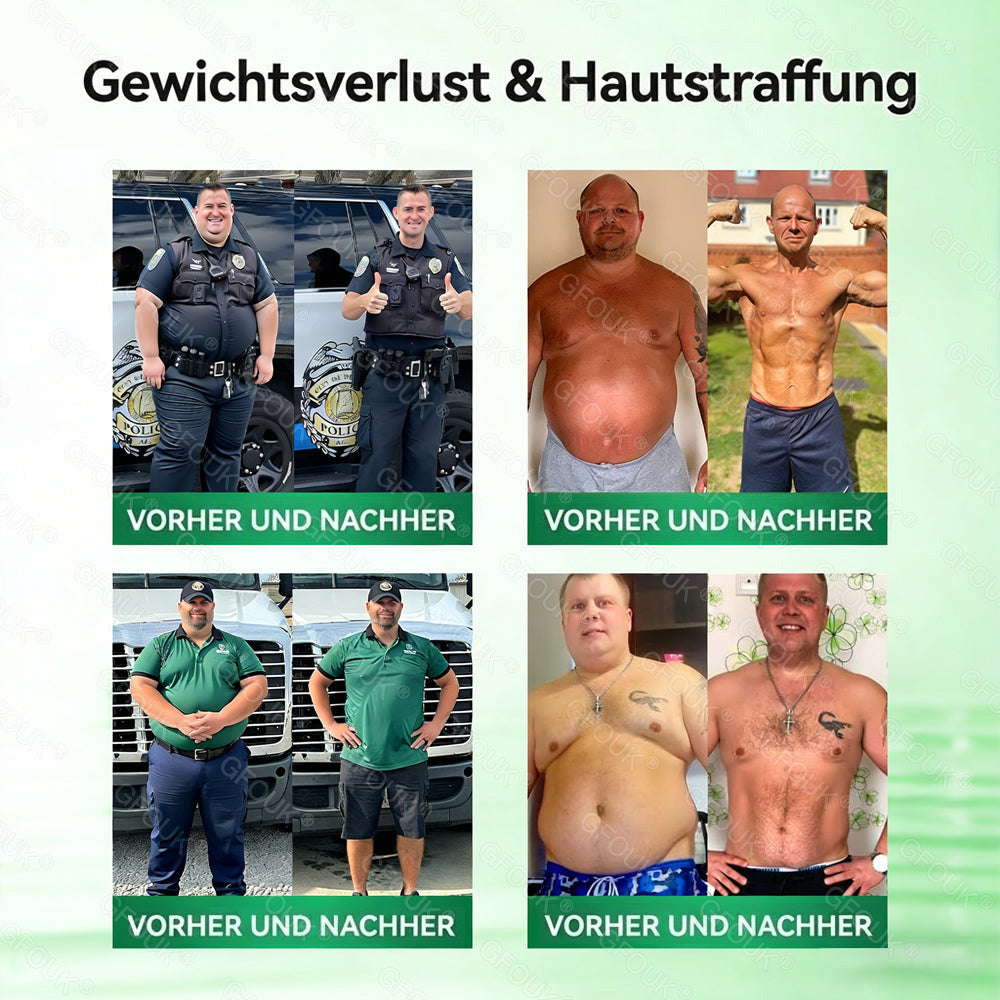 🇩🇪Offizieller Shop | 💕 GFOUK® Moringa Berberinex NAD+ 10-in-1 Nano-Mikronadel-Patch (Nur einmal täglich, sichtbare Veränderungen in 7 Tagen) ✅ Für Übergewicht, lockere Haut, Diabetes, Schlafapnoe, Gelenkprobleme und mehr