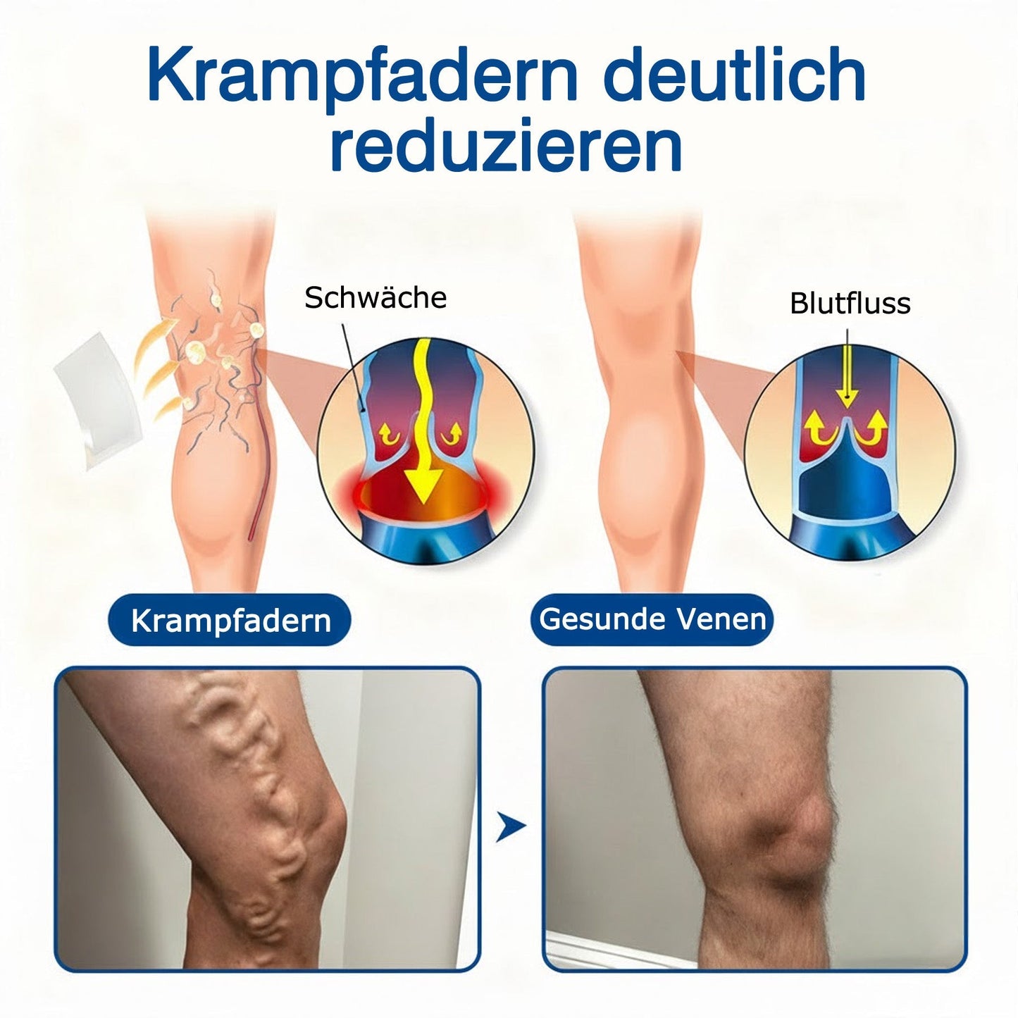 🇩🇪 🥰GFOUK® VeinTarget Mikronadel-Pflaster ⚡ Sofortige Linderung, Langfristige Ergebnisse