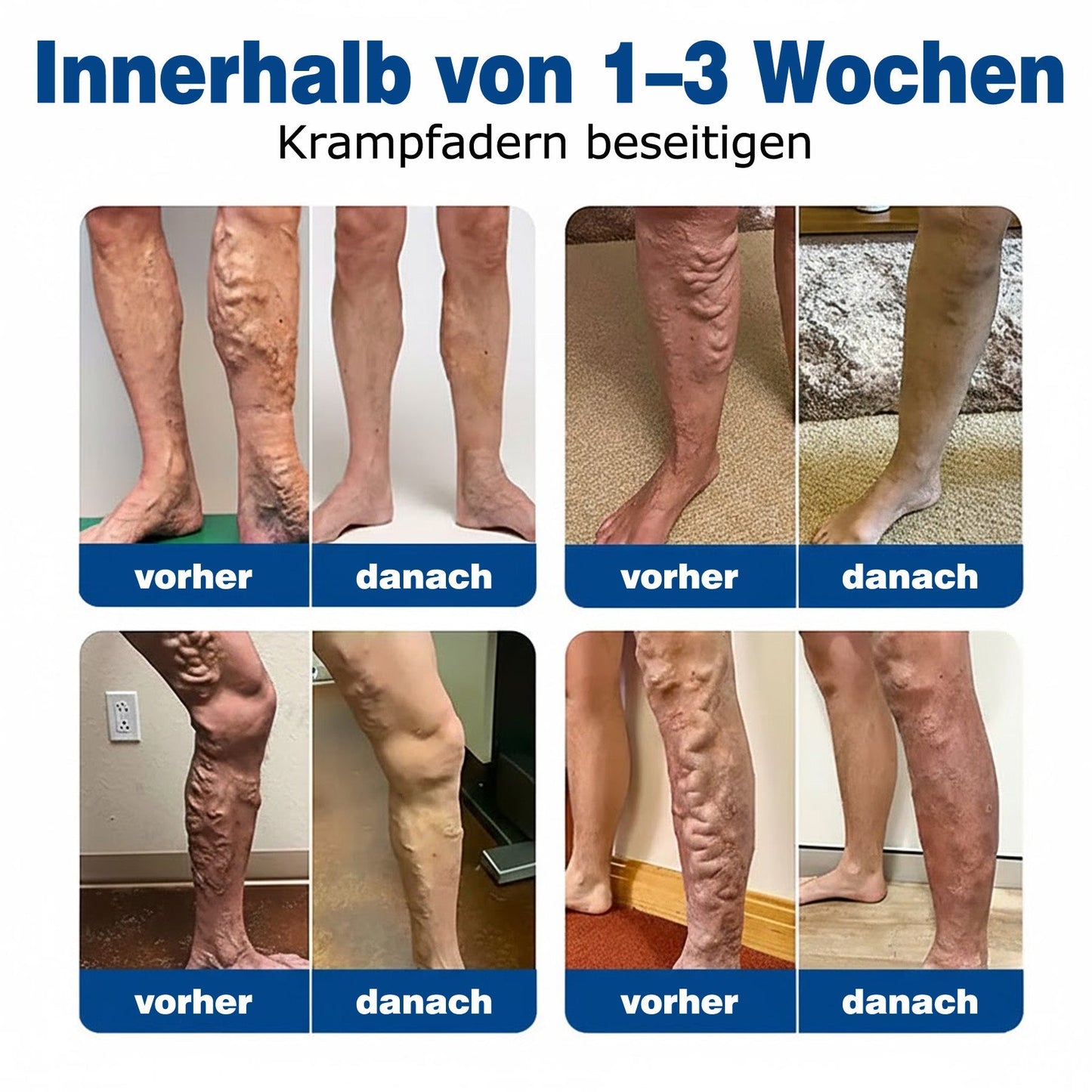 🇩🇪 🥰GFOUK® VeinTarget Mikronadel-Pflaster ⚡ Sofortige Linderung, Langfristige Ergebnisse