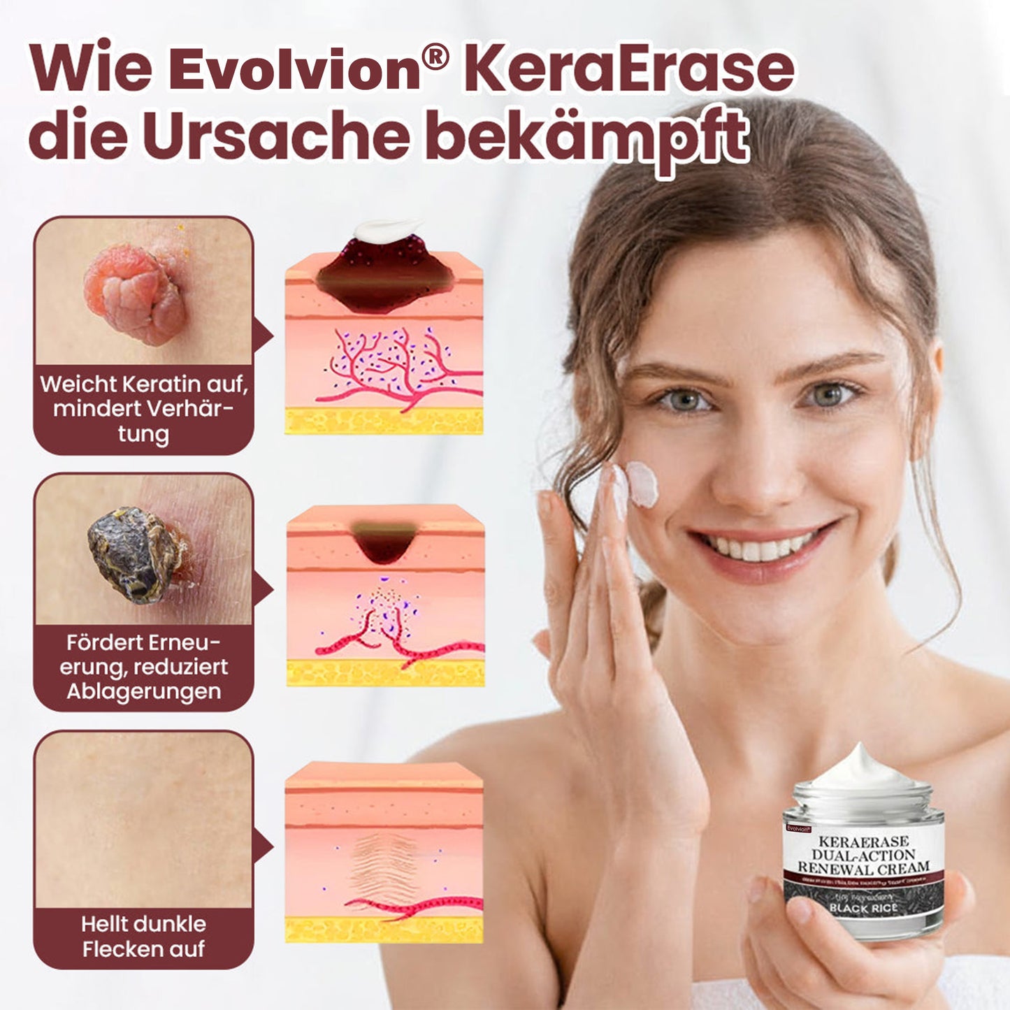 𝙀𝙫𝙤𝙡𝙫𝙞𝙤𝙣® KeraErase Dual-Action Erneuerungscreme