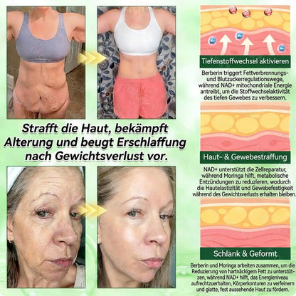 🇩🇪Offizieller Shop | 💕 GFOUK® Moringa Berberinex NAD+ 10-in-1 Nano-Mikronadel-Patch (Nur einmal täglich, sichtbare Veränderungen in 7 Tagen) ✅ Für Übergewicht, lockere Haut, Diabetes, Schlafapnoe, Gelenkprobleme und mehr
