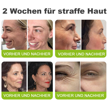 🛡️Jetzt jugendliche Haut zurückgewinnen Rolimey® Botox & Vita-A Retinol Shot Falten-Lift Straffungscreme