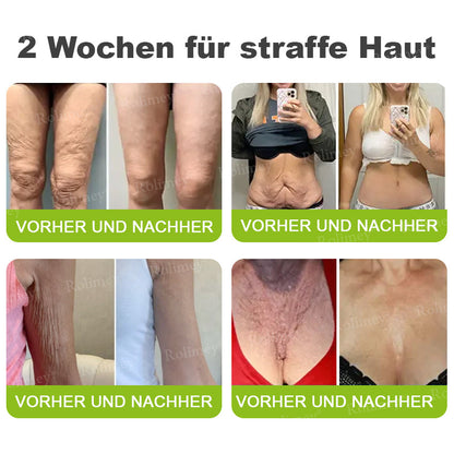 🛡️Jetzt jugendliche Haut zurückgewinnen Rolimey® Botox & Vita-A Retinol Shot Falten-Lift Straffungscreme