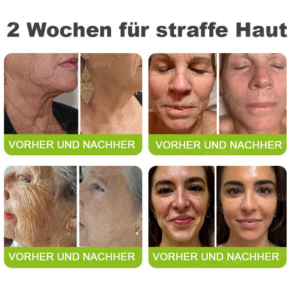 🛡️Jetzt jugendliche Haut zurückgewinnen Rolimey® Botox & Vita-A Retinol Shot Falten-Lift Straffungscreme